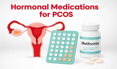 Dr Mamta Agrawal Best Gynaecologist Illustration showing hormonal treatment options for PCOS including medications